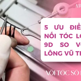 noi